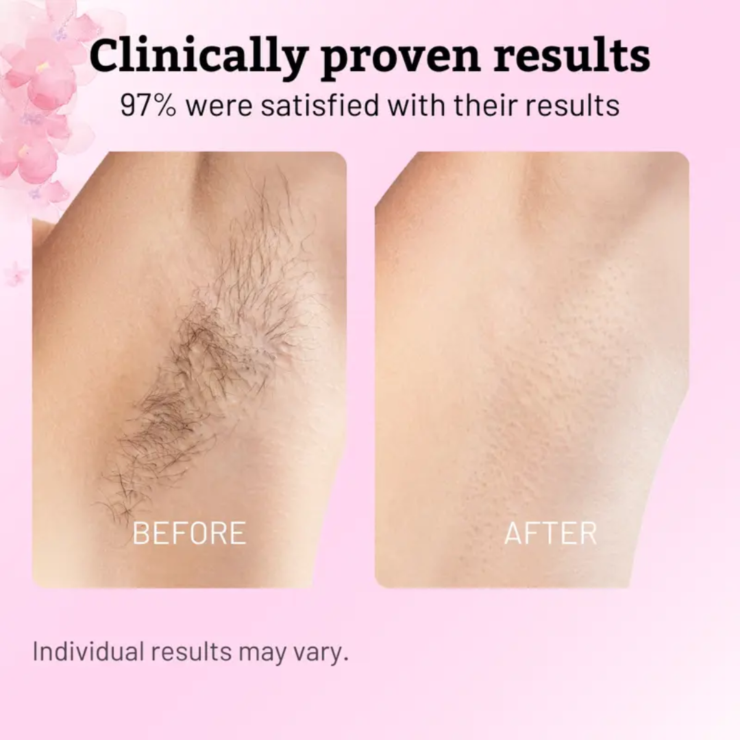 Harvestly Natural Hair Removal Serum